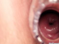 Insatiable brunette overweight granny in steamy black stockings sits in the gynecological chair. She sticks a gynecological speculum inside her gaped pussy in close up sex scenes by Naughty Head Nurse.