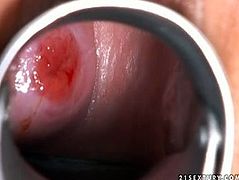 I guess this arousing blond fairy is having her period as you can see it through gynecological speculum, however it doesn't stop her from steamy masturbation with a dildo in sultry solo sex video by 21 Sextury.