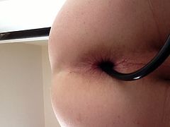 Anal balloon gape