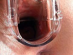 Teen Pussy Explored With Speculum