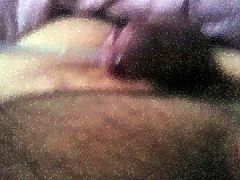 catheter-standing limb