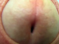 My foreskin