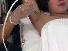 armpit treatment 1