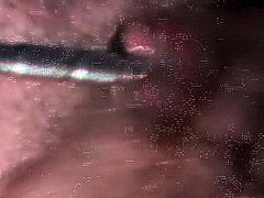 man sounding and ejaculation