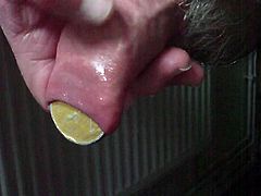 Further adventures of large chocolate coins in foreskin