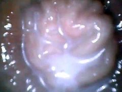 Inside Vagina - Closeup